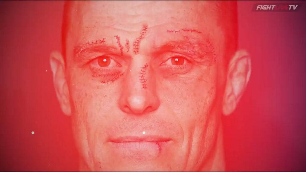 John Wayne Parr berättar om hur han fick över 300 stygn på ansiktet.